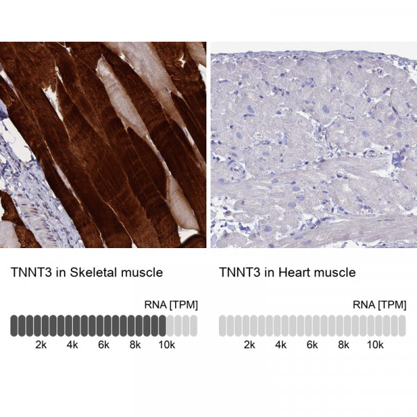 Anti-TNNT3