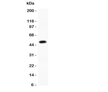 Anti-CCL7 (MCP3)