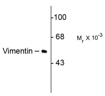 Anti-Vimentin, clone 2D1