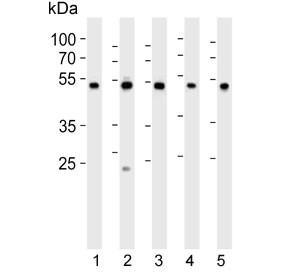 Anti-PDIA6