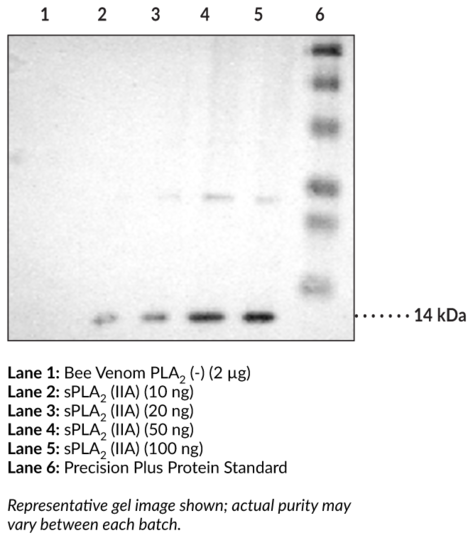 Anti-sPLA2 (human Type IIA) Antiserum