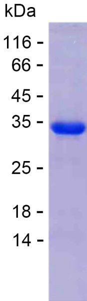 Recombinant Human AIM2 Protein