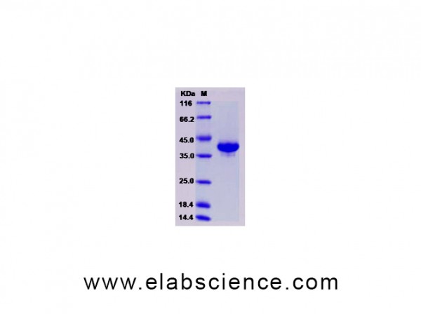 Human Resistin / ADSF / RETN Protein (Fc Tag)