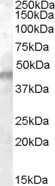 Anti-Kcnj11 / Kir6.2, Internal (near the N-term)