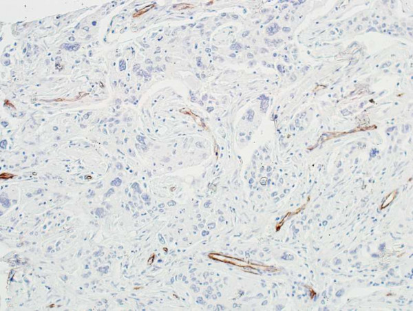 Anti-VE-Cadherin Recombinant Monoclonal