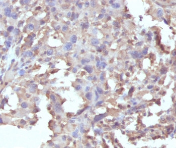 Anti-TNF alpha, clone RMTNFA-1