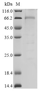 Liver carboxylesterase 1 (CES1), human, recombinant