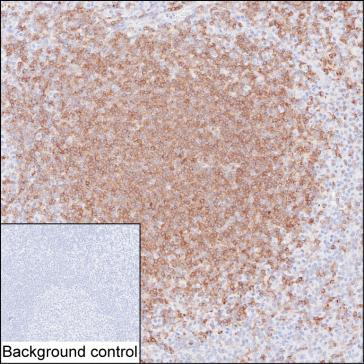 Anti-CD22