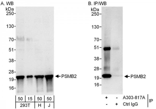 Anti-PSMB2