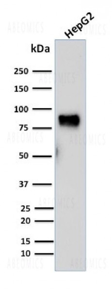 Anti-MDM2 Monoclonal Antibody (Clone: SMP14)