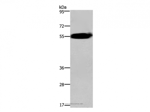 Anti-ACVR2A