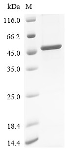Protein mono-ADP-ribosyltransferase PARP10 (PARP10), partial, human, recombinant