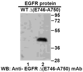 Anti-EGFR (E746-A750)del