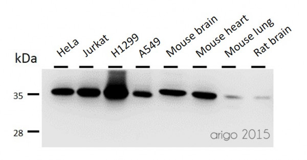 Anti-Lactate Dehydrogenase B