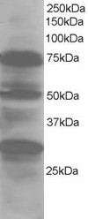 Anti-LMO7 / FBXO20, Internal