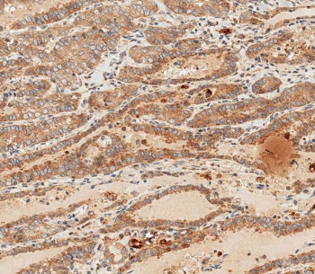 Anti-WNT5A
