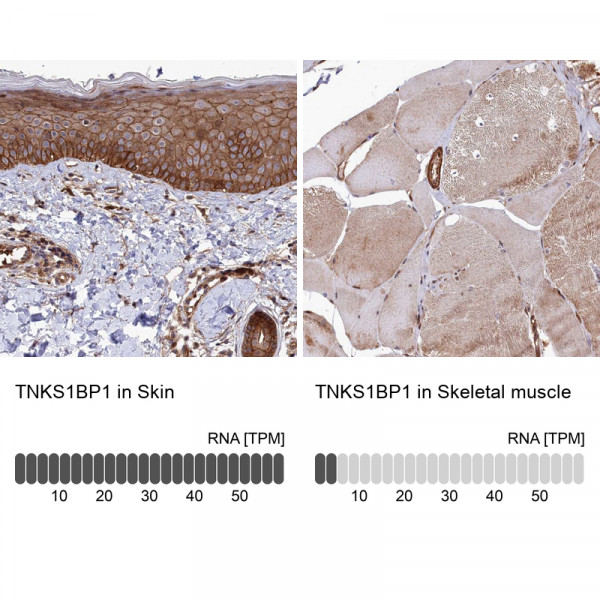 Anti-TNKS1BP1