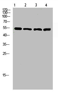Anti-ATP6AP1