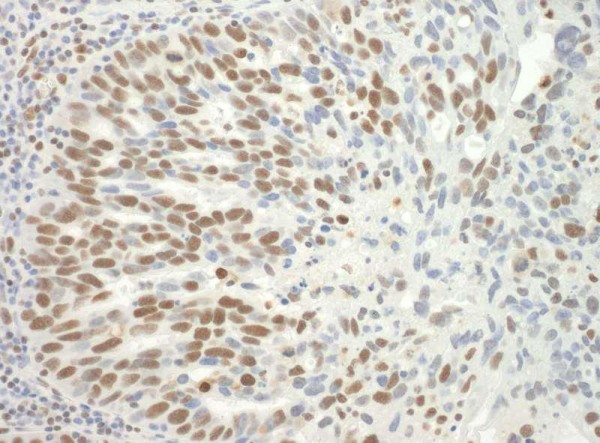 Anti-SF3B3 (IHC)