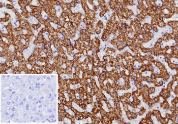 Anti-CPS1 / Carbamoyl-phosphate synthase 1, clone CPS1/9870