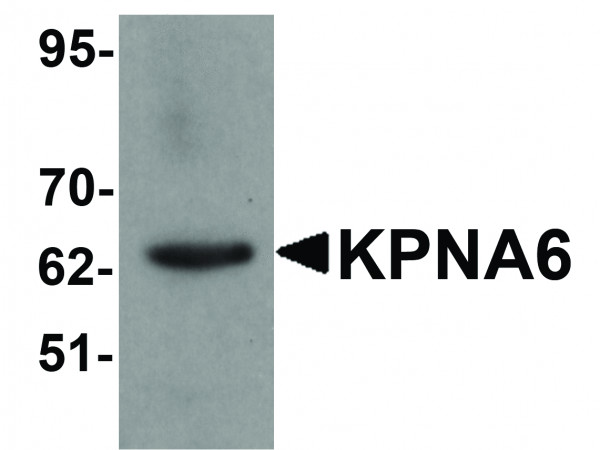 Anti-KPNA6