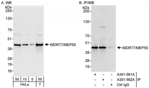 Anti-WDR77/MEP50