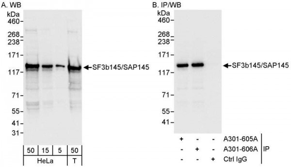 Anti-SF3b145/SAP145