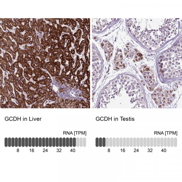 Anti-GCDH