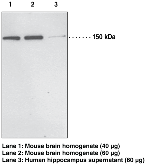 Anti-PH Domain Leucine-rich Repeat Protein Phosphatase 1