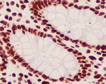 Anti-acetyl-Histone H2B (Lys20)