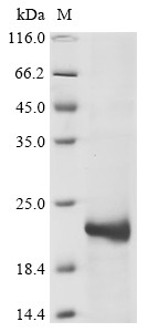 Snaclec rhodocytin subunit beta, Calloselasma rhodostoma, recombinant