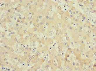 Anti-COQ4