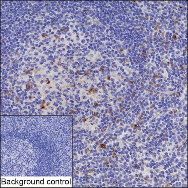 Anti-CD70