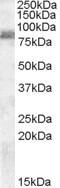 Anti-TRABID / ZRANB1, C-terminal