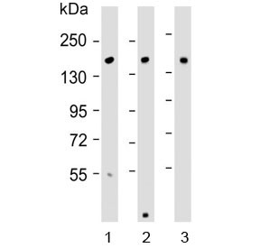 Anti-ATP7B