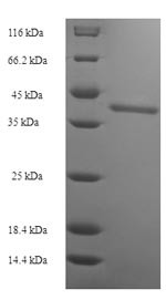 Protein SSX2 (SSX2), human, recombinant