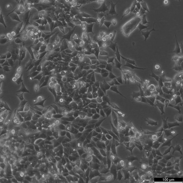 SNU-398 Cells