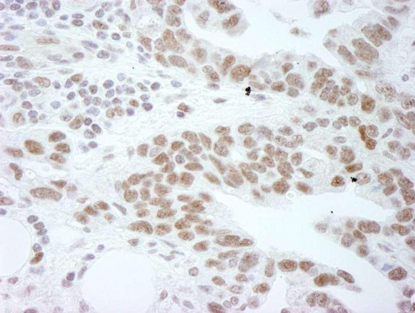 Anti-DDX1 (IHC)