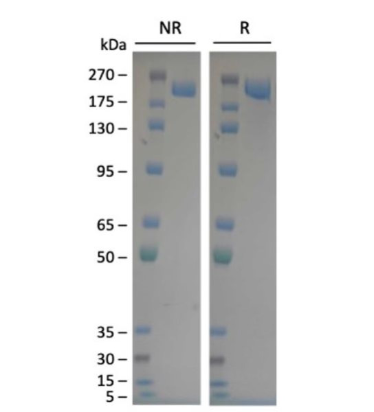 Spike Trimer (S1+S2) (BN.1, Omicron Variant), His-Tag (SARS-CoV-2) Recombinant
