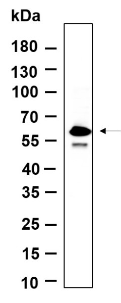Anti-Recombinant Phospho-SMAD5 (Ser463, Ser465), clone 9F5