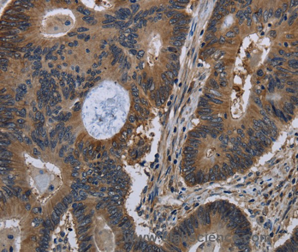 Anti-TSC22D3