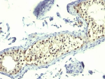 Anti-Thymidylate Synthase, clone TS106