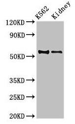 Anti-ALDH1A2