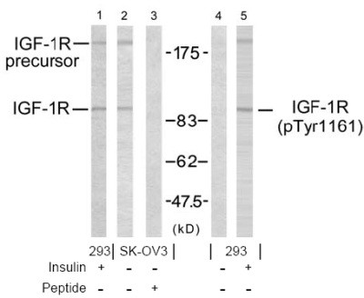 Anti-phospho-IGF-1R (Tyr1161)