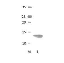 LNX1_2 PDZ Domain