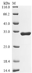 Dystrophin (Dmd), partial, rat, recombinant