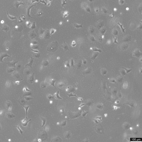 OAW-42 Cells
