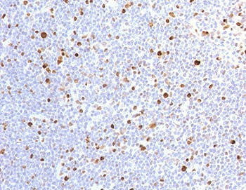 Anti-MCM7, clone MMCC7-1R