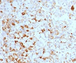 Anti-Luteinizing Hormone beta, clone LHb/1214