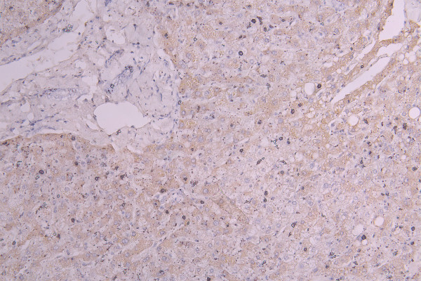 Anti-HAVCR1, recombinant clone 10A10